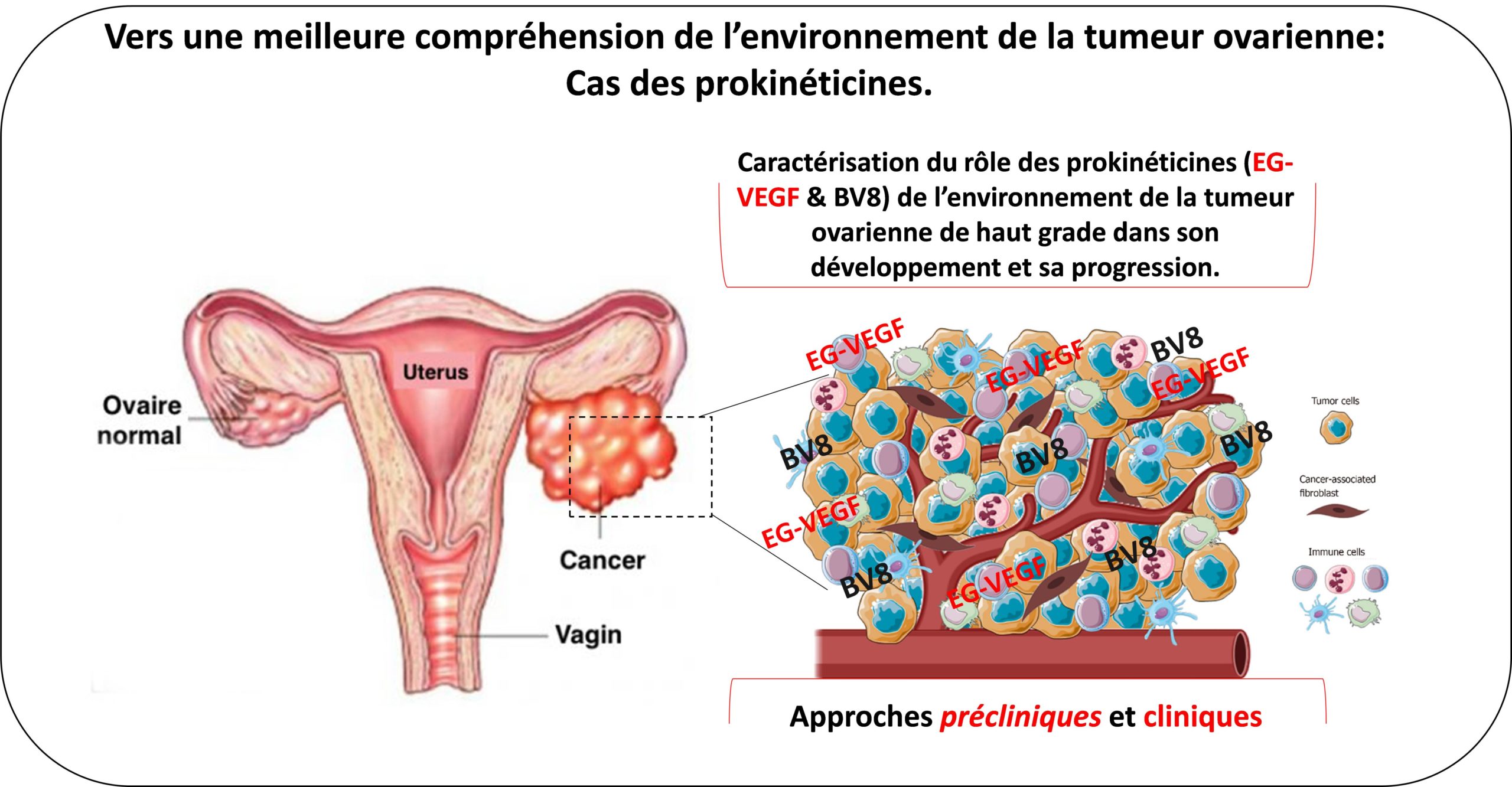 Vers une meilleure compréhension de l'environnement de la tumeur ovarienne
